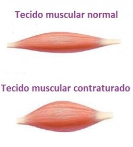 Musculatura.